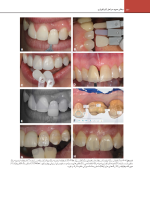 سایت رزنتال جلد دوم_Page_12 اصول نوین در پروتزهای دندانی رزنتال 2023 (جلد دوم) - Image 4