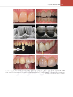 سایت رزنتال جلد دوم_Page_14 اصول نوین در پروتزهای دندانی رزنتال 2023 (جلد دوم) - Image 5