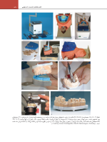 سایت رزنتال جلد دوم_Page_29 اصول نوین در پروتزهای دندانی رزنتال 2023 (جلد دوم) - Image 7