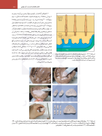 سایت رزنتال جلد دوم_Page_33 اصول نوین در پروتزهای دندانی رزنتال 2023 (جلد دوم) - Image 9