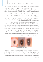 میکروسکوپ_Page_11 میکروسکوپ در دندانپزشکی (یک مقاله گروهی برای دندانپزشکان حرفه ای) - Image 12