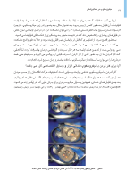 میکروسکوپ_Page_12 میکروسکوپ در دندانپزشکی (یک مقاله گروهی برای دندانپزشکان حرفه ای) - Image 13