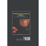 ساکشن پروتز کامل فک پایین به صورت "پیشرفته"