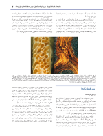 استئونکروز فکین ناشی از مصرف داروها - Image 8