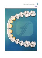 آناتومی دندان های قدامی و علم لبخند طبیعی - Image 7