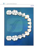 آناتومی دندان های قدامی و علم لبخند طبیعی - Image 8