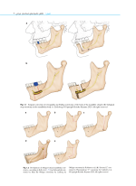 راهنمای مصور جراحی ارتوگناتیک - Image 8