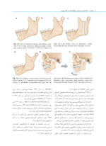 راهنمای مصور جراحی ارتوگناتیک - Image 9