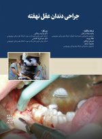 جراحی دندان عقل نهفته