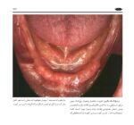 گام به گام با BPS - Image 11