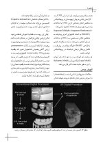 CDR پریودنتولوژی بالینی کارانزا 2024 (چکیده مراجع دندانپزشکی) - Image 7