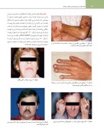 تدابیر دندانپزشکی در بیماران سیستمیک فالاس 2024 - Image 12