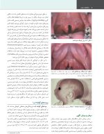 پاتولوژی دهان، فک و صورت نویل 2024 جلد یک (رنگی) - Image 6