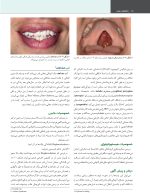 پاتولوژی دهان، فک و صورت نویل 2024 جلد یک (رنگی) - Image 4