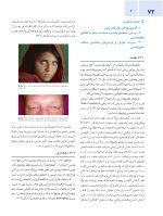 اصول جراحی دهان، فک و صورت پیترسون 2022 زیبایی - جلد چهارم - Image 7