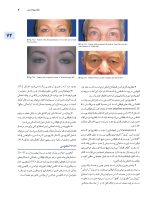 اصول جراحی دهان، فک و صورت پیترسون 2022 زیبایی - جلد چهارم - Image 8