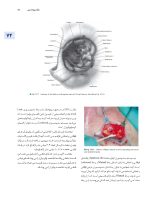 اصول جراحی دهان، فک و صورت پیترسون 2022 زیبایی - جلد چهارم - Image 10