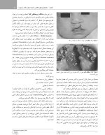 پاتولوژی دهان، فک و صورت نویل 2024 جلد یک (سیاه و سفید) - Image 7