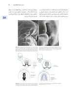 اصول جراحی دهان، فک و صورت پیترسون 2022 ارتوگناتیک - جلد سوم - Image 9