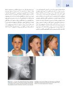 اصول جراحی دهان، فک و صورت پیترسون 2022 ارتوگناتیک - جلد سوم - Image 10