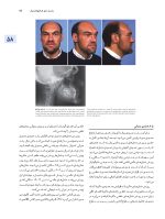 اصول جراحی دهان، فک و صورت پیترسون 2022 ارتوگناتیک - جلد سوم - Image 11