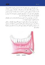 اصول بیوپسی، ضایعات دهان و اصول نسخه نویسی بیماری های دهان - Image 8