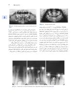 اصول جراحی دهان فک و صورت  پیترسون 2022 (جلد دوم) - Image 8