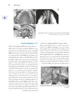 اصول جراحی دهان فک و صورت  پیترسون 2022 (جلد دوم) - Image 9