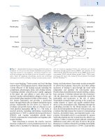 Peterson’s Principles of Oral and Maxillofacial Surgery 2022 (Two Vol) - Image 9