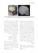 جراحی دهان، فک و صورت در کودکان جلد دوم: ترومای فک و صورت در کودکان - Image 3