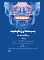 ایمپلنت های زایگوماتیک (مرحله به مرحله)