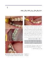 اطلس جراحی دندان عقل - Image 6