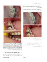 اطلس جراحی دندان عقل - Image 7