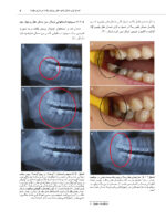 اطلس جراحی دندان عقل - Image 8