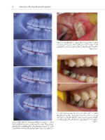 اطلس جراحی دندان عقل - Image 10