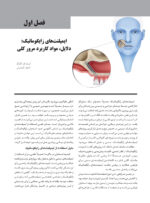 ایمپلنت های زایگوماتیک (مرحله به مرحله) - Image 8