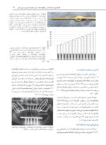 ایمپلنت های زایگوماتیک (مرحله به مرحله) - Image 4