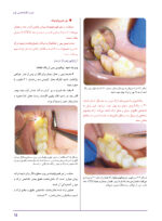 کیس های بالینی در اندودانتیکس - Image 8