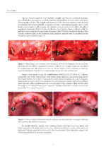 Advancements in Prosthodontics: Exploring Innovations in Rehabilitation Medicine 2025 - Image 8