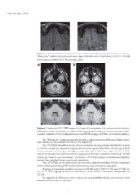 Clinical Advances in Head and Neck Imaging including Dentistry 2024 - Image 7