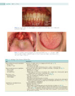 Oral Pathology 2024 (Third Edition) - Image 8