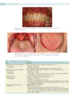 Oral Pathology 2024 (Third Edition) - Image 8