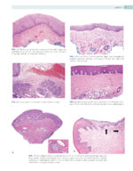 Oral Pathology 2024 (Third Edition) - Image 2
