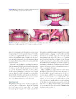 Dermal Fillers for Dental Professionals 2021 - Image 9