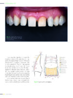 QUINTESSENCE OF DENTAL TECHNOLOGY (QDT 2023) - Image 4