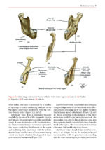 Transalveolar Extraction of the Mandibular Third Molars 2023 - Image 3