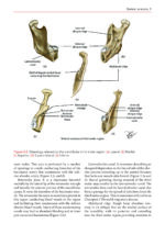 Transalveolar Extraction of the Mandibular Third Molars 2023 - Image 3