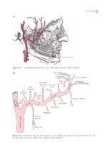 Impacted Third Molars 2024 - Image 8