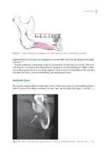 Impacted Third Molars 2024 - Image 10