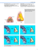 Dallas Rhinoplasty Nasal Surgery by the Masters (Fourth Edition) 2024 - Image 4